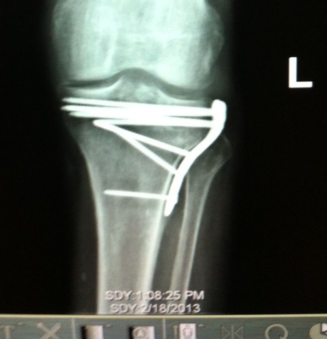 OT - hubby improving - Goats